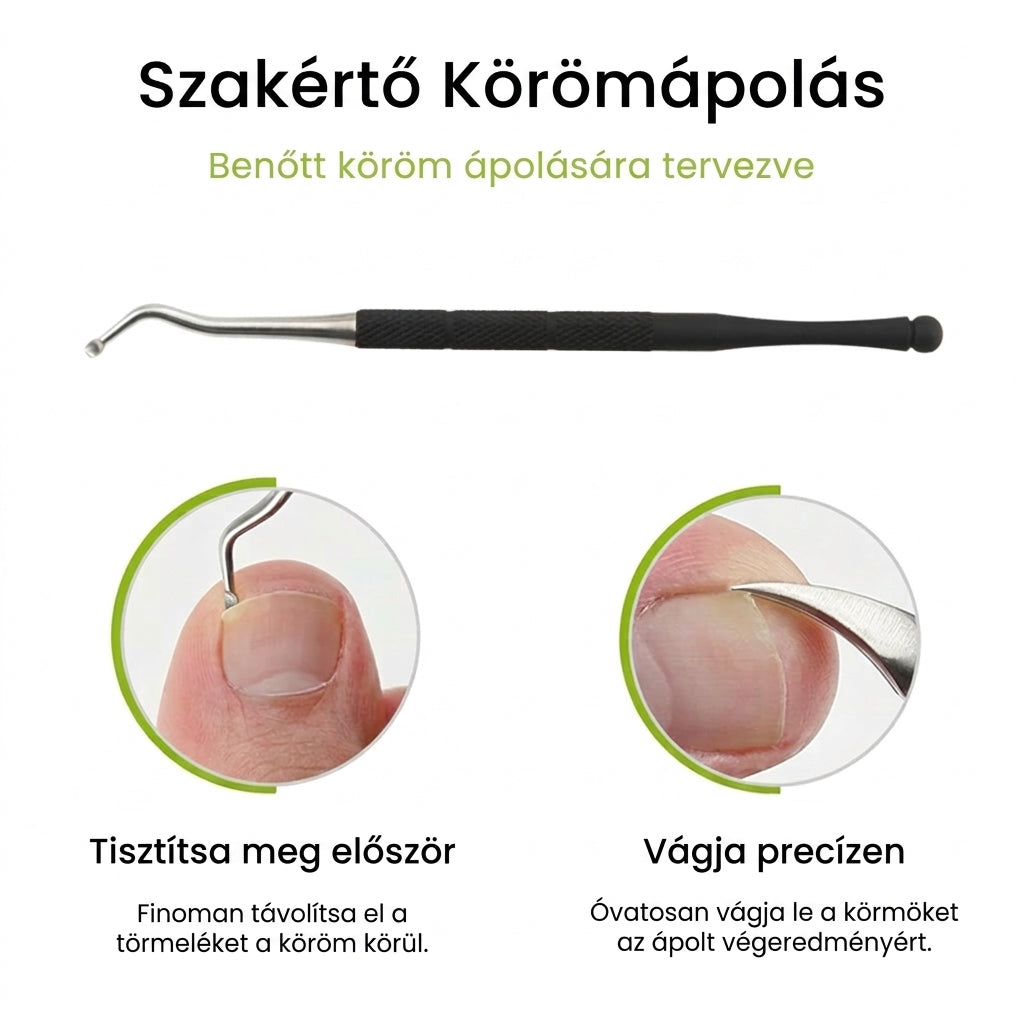 ✂️Precíziós benőtt körömvágó készlet